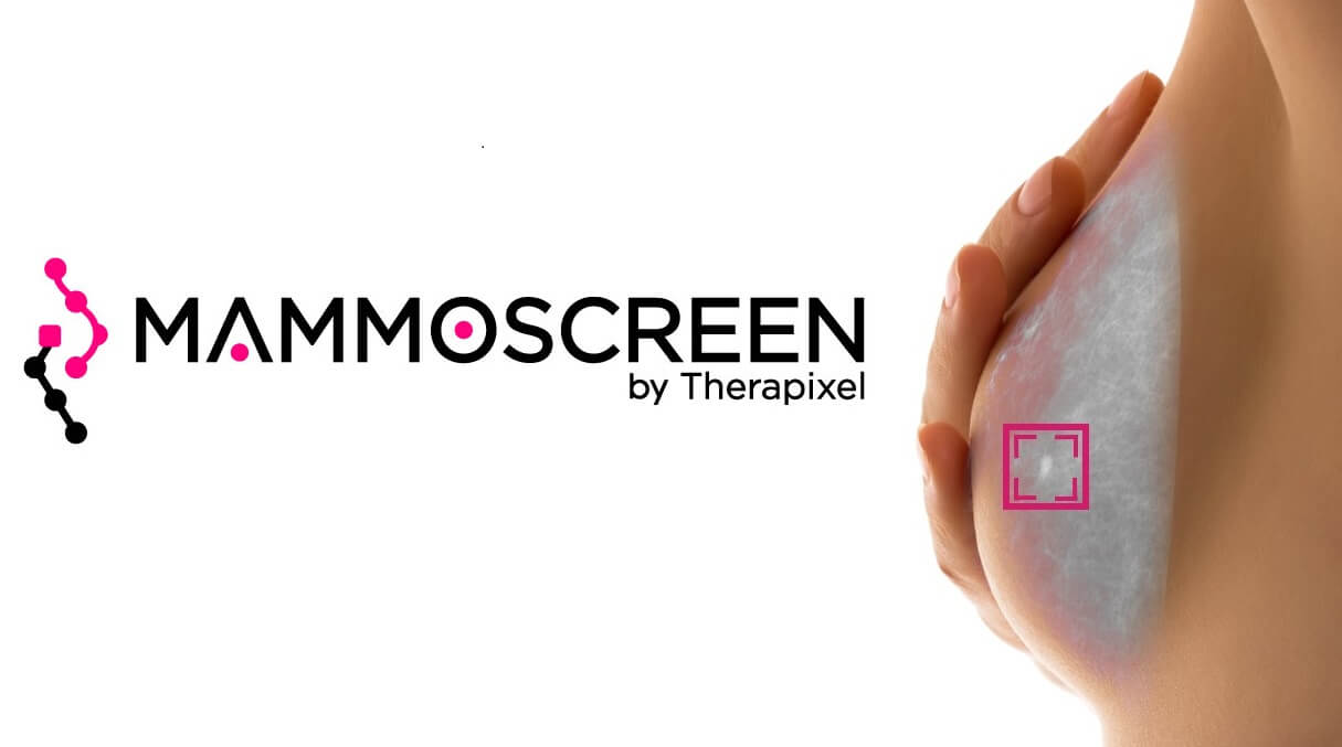 mammoscreen3